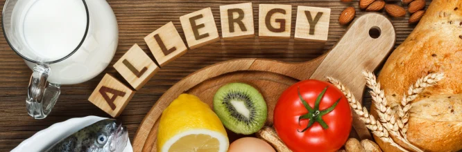 gestión de alérgenos alimentarios